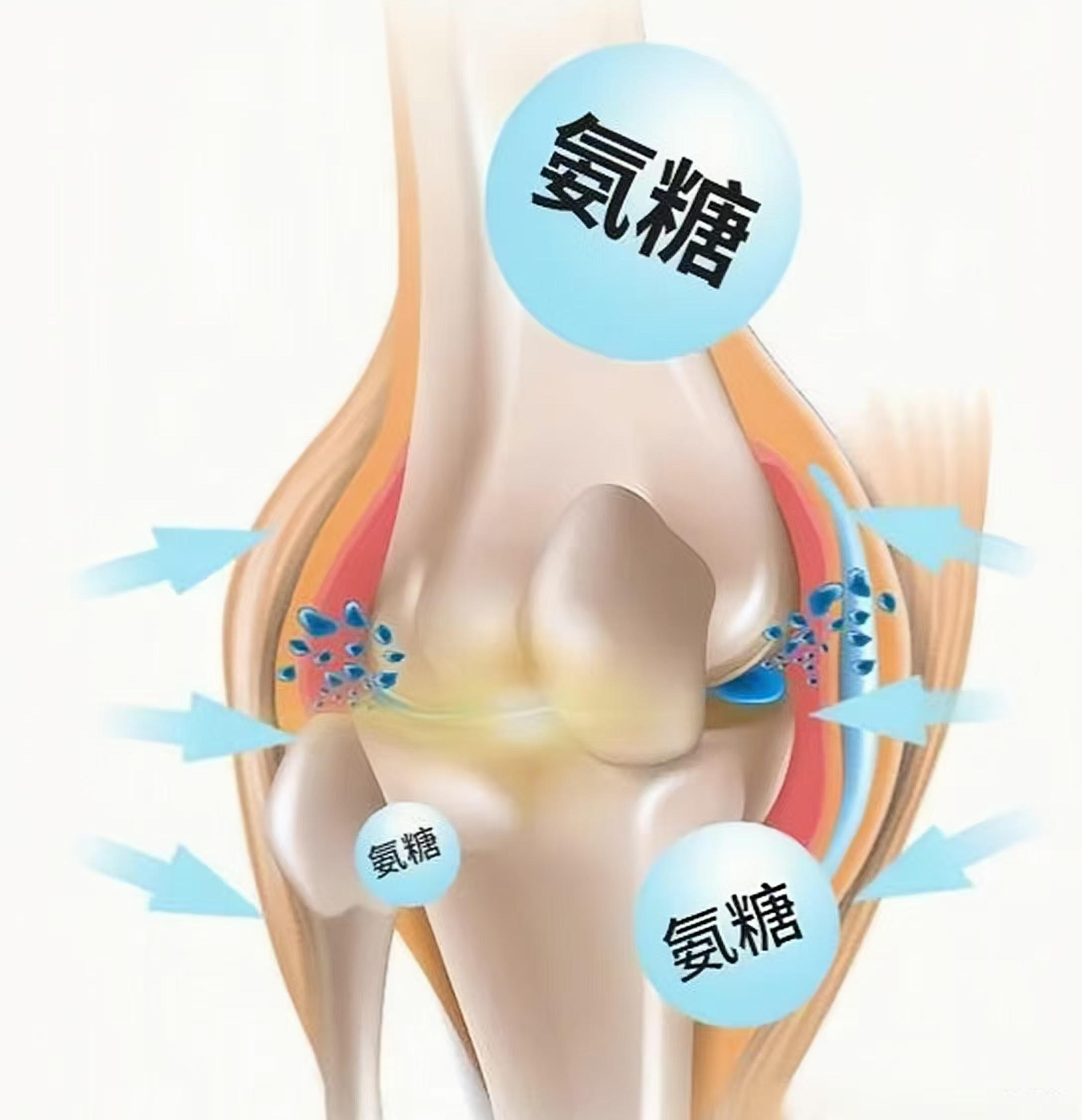 氨糖适合什么样的人群补充？