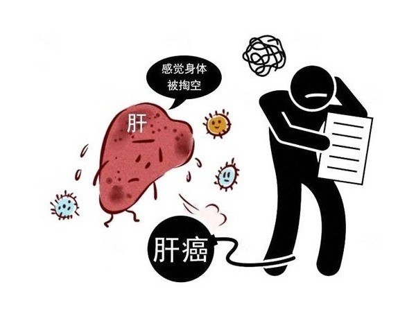健康小知识：肝癌饮食宜忌